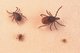 lyme-ticks - 